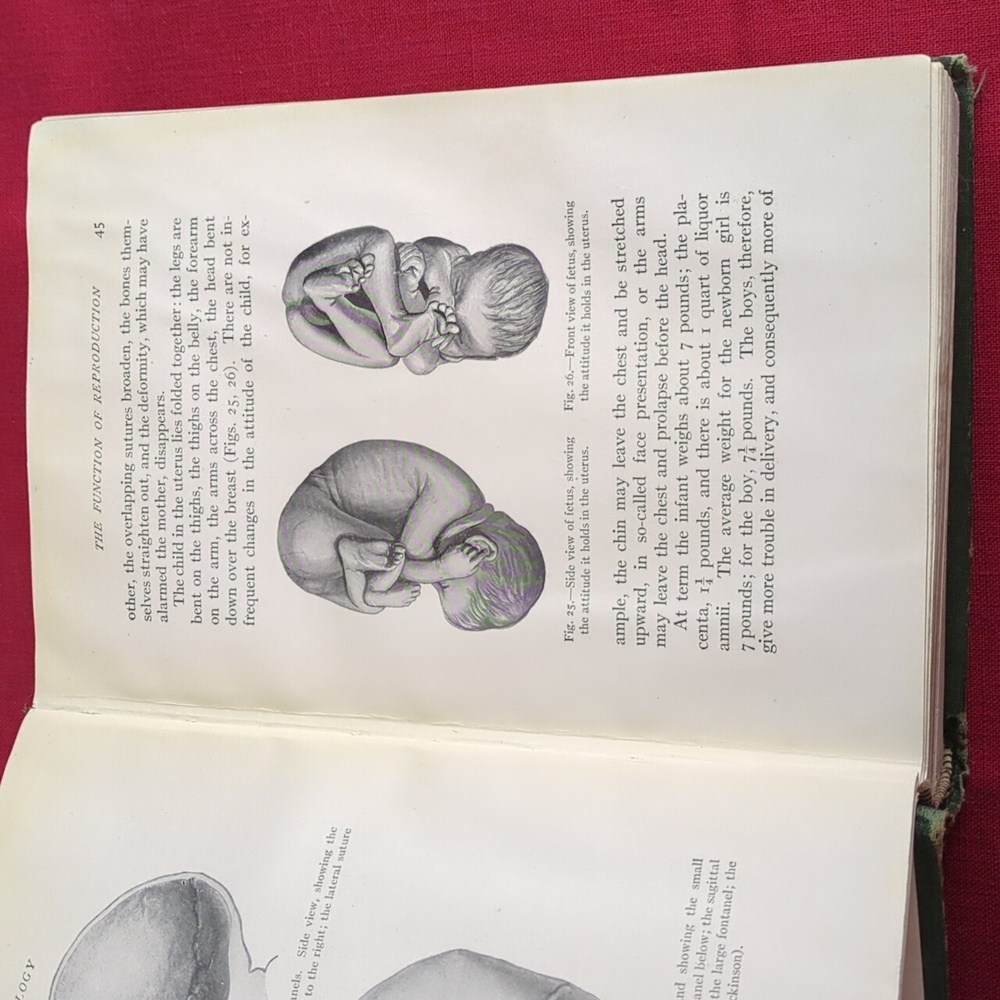 Antique 1915 Obstetrics For Nurses Book - Picture 9 of 13